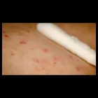 Immagine 4 azienda ANALAB LABORATORIO ANALISI POLIAMBULATORIO DELLA DOTT.SSA G. GIUSINO Salute in Catania