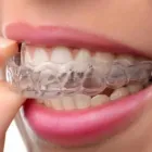 Immagine 6 azienda AVTRE POLIAMBULATORIO ODONTOIATRICO Salute in Modena