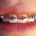 Immagine 2 azienda BERTANI DR. PIO DENTISTA Salute in Parma Pr