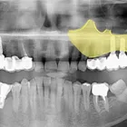 Immagine 1 azienda BOLOGNADENT MODENA – DENTISTA Salute in Modena