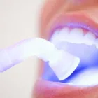 Immagine 2 azienda BOLOGNADENT MODENA – DENTISTA Salute in Modena