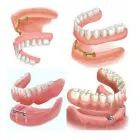 Immagine 3 azienda BOLOGNADENT MODENA – DENTISTA Salute in Modena