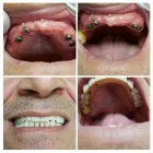 Immagine 1 azienda CENTRO DENTALE ITALDENT Salute in Taranto