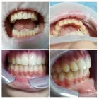 Immagine 2 azienda CENTRO DENTALE ITALDENT Salute in Taranto