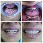 Immagine 4 azienda CENTRO DENTALE ITALDENT Salute in Taranto