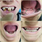 Immagine 6 azienda CENTRO DENTALE ITALDENT Salute in Taranto