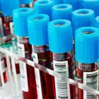 Immagine 1 azienda CENTRO DI TERAPIA IONOFORETICA Salute in Bologna