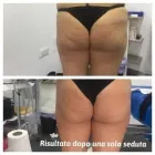 Immagine 2 azienda CENTRO ESTETICO AFRODITE Servizi di bellezza in Napoli
