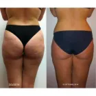 Immagine 1 azienda CENTRO ESTETICO BELLEZZA E BENESSERE Servizi di bellezza in Torino