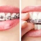 Immagine 4 azienda CENTRO ODONTOIATRICO SMILE Salute in Frattaminore NA