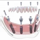 Immagine 5 azienda CENTRO ODONTOIATRICO SMILE Salute in Frattaminore NA