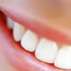 Immagine 1 azienda D.E. DENTAL Salute in Modena