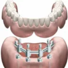 Immagine 2 azienda DOTT. E. YOUSEFIAN ODONTOIATRA Salute in Guidonia Montecelio RM