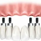 Immagine 4 azienda DOTT. E. YOUSEFIAN ODONTOIATRA Salute in Guidonia Montecelio RM