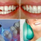 Immagine 6 azienda DOTT. E. YOUSEFIAN ODONTOIATRA Salute in Guidonia Montecelio RM