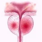 Immagine 3 azienda DR ANDREA MILITELLO UROLOGO-ANDROLOGO Salute in Roma