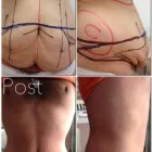 Immagine 1 azienda DR PIERFRANCESCO BOVE CHIRURGO PLASTICO ESTETICO Salute in Salerno