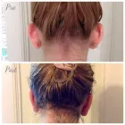 Immagine 2 azienda DR PIERFRANCESCO BOVE CHIRURGO PLASTICO ESTETICO Salute in Salerno