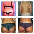 Immagine 3 azienda DR PIERFRANCESCO BOVE CHIRURGO PLASTICO ESTETICO Salute in Salerno