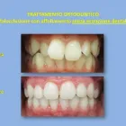 Immagine 1 azienda GENOVIVA DOTT.SSA ROBERTA ESTHETIC DENTISTRY Salute in Taranto