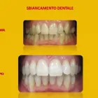 Immagine 2 azienda GENOVIVA DOTT.SSA ROBERTA ESTHETIC DENTISTRY Salute in Taranto