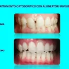 Immagine 4 azienda GENOVIVA DOTT.SSA ROBERTA ESTHETIC DENTISTRY Salute in Taranto