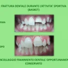 Immagine 6 azienda GENOVIVA DOTT.SSA ROBERTA ESTHETIC DENTISTRY Salute in Taranto