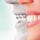 Immagine 6 azienda LA.DE.SA. AMBULATORIO ODONTOIATRICO Salute in Sassuolo MO