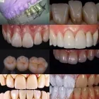 Immagine 2 azienda LABORATORIO ODONTOTECNICO MURTAS Salute in Cagliari