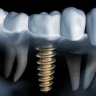 Immagine 5 azienda PANZIERA DR. GIOVANNI Salute in Verona