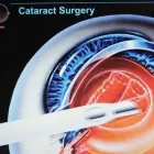 Immagine 7 azienda SANTOCONO DR. MARCELLO OCULISTA Salute in Catania