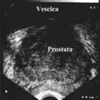 Immagine 1 azienda SPURI DR. PAOLO UROLOGO Urologo in Civitavecchia RM