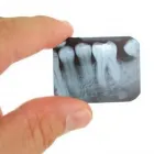 Immagine 1 azienda STUDIO DENTISTICO CAVALLINI Salute in Pisa