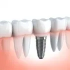 Immagine 3 azienda STUDIO DENTISTICO CAVALLINI Salute in Pisa