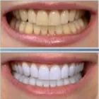 Immagine 1 azienda STUDIO DENTISTICO DOTT. FRANCESCO PATTI Salute in Palermo