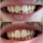 Immagine 6 azienda STUDIO DENTISTICO ERCOLE DORIGO Salute in Parma Pr