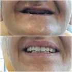 Immagine 7 azienda STUDIO DENTISTICO ERCOLE DORIGO Salute in Parma Pr