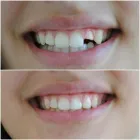 Immagine 8 azienda STUDIO DENTISTICO ERCOLE DORIGO Salute in Parma Pr