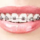 Immagine 5 azienda STUDIO DENTISTICO RAVASINI Salute in Parma