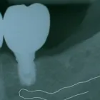 Immagine 8 azienda STUDIO DENTISTICO RAVASINI Salute in Parma