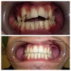 Immagine 1 azienda STUDIO DENTISTICO VOLPE Salute in Salerno