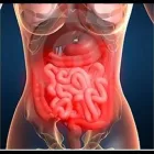 Immagine 1 azienda STUDIO DI GASTROENTEROLOGIA E EPATOLOGIA CLAAR Salute in Napoli