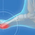 Immagine 1 azienda STUDIO DI PODOLOGIA MATTIONI Salute in Torino