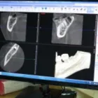 Immagine 1 azienda TERAMED CENTRO MEDICO DENTISTICO Salute in Montella AV