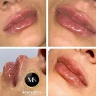 Immagine 1 azienda TRICOPIGMENTAZIONE E MICROBLANDING - DR MONICA SECCA Tatuaggio e piercing in Roma