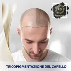 Immagine 4 azienda TRICOPIGMENTAZIONE E MICROBLANDING - DR MONICA SECCA Tatuaggio e piercing in Roma