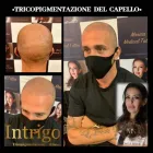 Immagine 5 azienda TRICOPIGMENTAZIONE E MICROBLANDING - DR MONICA SECCA Tatuaggio e piercing in Roma