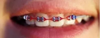 Immagine 2 azienda BERTANI DR. PIO DENTISTA Salute in Parma Pr