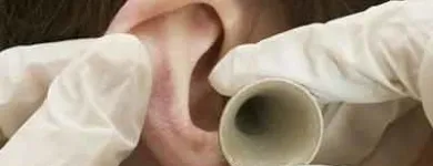 Immagine 1 azienda BOSCHI DR.SSA MARILENA OTORINOLARINGOIATRA Salute in Ravenna