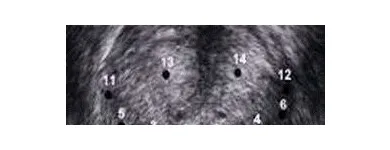 Immagine 5 azienda DR ANDREA MILITELLO UROLOGO-ANDROLOGO Salute in Roma